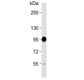 Western blot testing of rat skeletal muscle lysate with TSP5 antibody. Expected molecular weight: 83-100 kDa depending on glycosylation level.