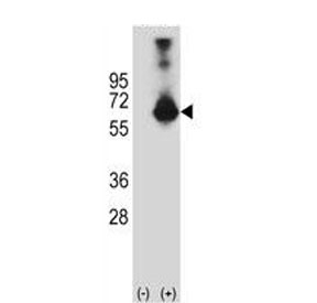 Western blot testing of 1) non-transfected and 2) transfected 293 cell lysate with Cystathionine Beta Synthase antibody. 