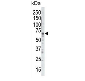 Western blot testing of mouse brain lysate with GRK5 antibody. Predicted molecular weight ~68 kDa.