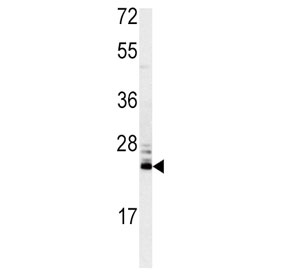 Western blot testing of mouse kidney lysate with MSRA antibody. Predicted molecular weight ~26 kDa.