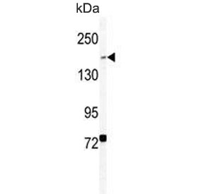 Western blot testing of human HEK293 cell lysate with BCOR antibody. Predicted molecular weight ~192 kDa.