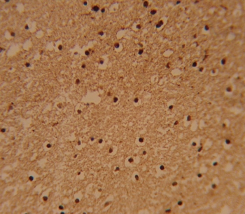 IHC testing of FFPE human brain tissue with PSMB1 antibody. HIER: steam section in pH6 citrate buffer for 20 min and allow to cool prior to staining.