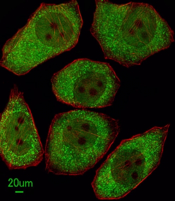 ALOX12 Antibody A549 Cell IF. Immunofluorescent staining of human A549 cells with ALOX12 antibody (green) and anti-Actin antibody (red). ALOX12 immunoreactivity is observed predominantly within the cytoplasm in a punctate distribution, consistent with the expected localization of 12S-Lipoxygenase (ALOX12), a lipid peroxidation enzyme that catalyzes arachidonic acid metabolism and generates bioactive lipid mediators involved in inflammatory signaling, oxidative stress, ferroptosis, and regulation of cellular homeostasis. Actin (red) highlights the cytoskeletal network and cellular morphology.