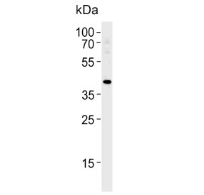 TBX1 Antibody Endothelial Cell WB. Western blot analysis of human HUVEC cell lysate using TBX1 Antibody / Developmental Transcription Factor Antibody demonstrates a distinct band at approximately 43 kDa, consistent with the predicted molecular weight of T-Box Transcription Factor 1 (TBX1). TBX1 is a T-box family transcription factor that regulates developmental gene expression programs involved in embryonic patterning, organogenesis, and tissue morphogenesis. Expression of TBX1 has been associated with developmental pathways governing cardiovascular, craniofacial, pharyngeal, and neural tissue formation. Detection of TBX1 in human endothelial cells is consistent with its established role in developmental signaling networks that contribute to cardiovascular development and tissue organization. The observed band supports the utility of this antibody for western blot analysis of TBX1 expression. Predicted molecular weight: ~43 kDa.