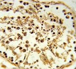TBX1 Antibody Human Testis IHC. Immunohistochemical staining of FFPE human testis tissue using TBX1 Antibody / Developmental Transcription Factor Antibody demonstrates prominent nuclear HRP-DAB brown staining within cells of the seminiferous tubules. TBX1 is a T-box family transcription factor that regulates developmental gene expression programs involved in tissue specification, cellular differentiation, and organogenesis. As a DNA-binding regulatory protein, TBX1 functions primarily within the nucleus where it controls transcriptional networks that coordinate developmental and cell fate determination pathways. The observed nuclear staining pattern is consistent with the expected localization of a transcription factor and supports the utility of this antibody for immunohistochemical detection of TBX1 expression in human tissues. HIER: steam tissue sections in pH 6 citrate buffer for 20 minutes and allow to cool prior to staining.