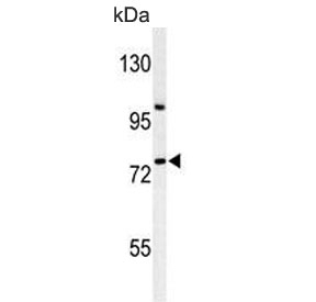 Western blot testing of human HepG2 cell lysate with ZNF202 antibody. Predicted molecular weight ~75 kDa.