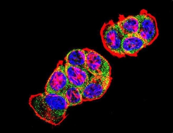 Immunofluorescent staining of human T-47D cells with Catenin Beta antibody (green), DAPI nuclear stain (blue) and anti-Actin (red).