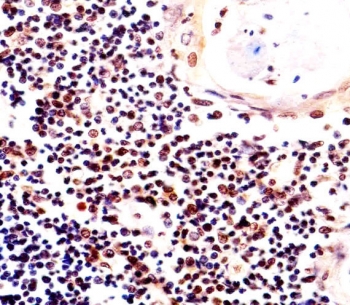 Histone H2AX Antibody Immunohistochemistry. IHC testing of FFPE human thymus tissue with Histone H2AX antibody. HIER: steam section in pH6 citrate buffer for 20 min and allow to cool prior to staining.