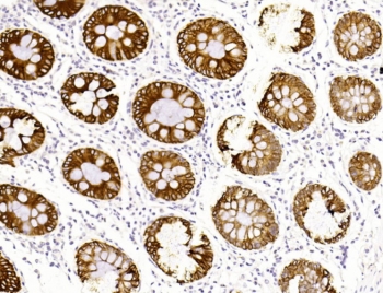 IHC testing of FFPE human colon tissue with Keratin 19 antibody. HIER: steam section in pH6 citrate buffer for 20 min and allow to cool prior to staining.