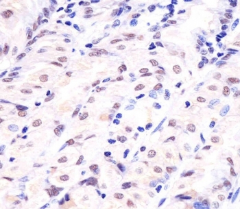 IHC testing of FFPE human stomach tissue with APE1 antibody. HIER: steam section in pH6 citrate buffer for 20 min and allow to cool prior to staining.