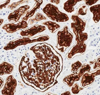 IHC testing of FFPE human kidney tissue with CD10 antibody. HIER: steam section in pH6 citrate buffer for 20 min and allow to cool prior to staining.