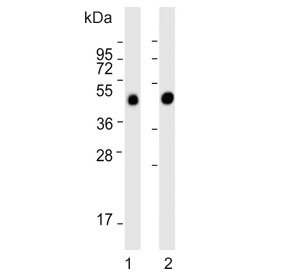 Western blot testing of 1) human liver and 2) rat liver lysate with METTL4 antibody. Predicted molecular weight ~54 kDa.