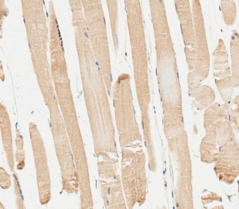IHC testing of FFPE human skeletal muscle tissue with IRF7 antibody. HIER: steam section in pH6 citrate buffer for 20 min and allow to cool prior to staining.