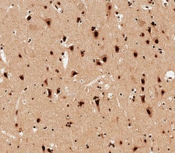 IHC testing of FFPE human brain tissue with SNRPD3 antibody. HIER: steam section in pH6 citrate buffer for 20 min and allow to cool prior to staining.