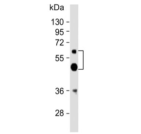 Western blot testing of human liver lysate with UGT2B4 antibody. Predicted molecular weight: 43/46/61 kDa (three isoforms).