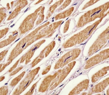 IHC testing of FFPE human heart tissue with zebrafish Ak2 antibody. HIER: steam section in pH6 citrate buffer for 20 min and allow to cool prior to staining.