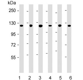 Western blot testing of 1) human skeletal muscle, 2) human A431, 3) human HeLa, 4) mouse kidney, 5) rat PC-12 and 6) human HepG2 cell lysate with Vinculin antibody. Predicted molecular weight ~124 kDa.