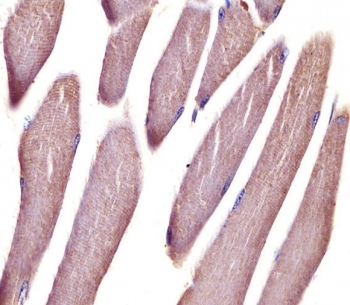 IHC testing of FFPE mouse skeletal muscle tissue with Vinculin antibody. HIER: steam section in pH6 citrate buffer for 20 min and allow to cool prior to staining.