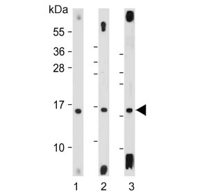 Western blot testing of 1) human brain, 2) mouse brain and 3) rat brain lysate with MAP1LC3A antibody. Predicted molecular weight ~14 kDa.
