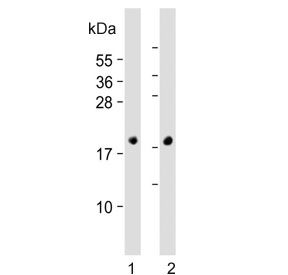 NPPA Antibody Human Fetal Heart and Mouse Heart WB. Western blot analysis of human fetal heart and mouse heart tissue lysates using NPPA antibody demonstrates distinct immunoreactive bands at approximately 17 kDa in both samples, consistent with the expected molecular weight of Natriuretic Peptide Precursor A (NPPA). NPPA is the precursor protein for Atrial Natriuretic Peptide (ANP/ANF), a cardiac-derived hormone that regulates cardiovascular homeostasis, fluid balance, and endocrine signaling pathways. The conserved detection of NPPA in both human and mouse cardiac tissues supports the utility of this antibody for studies of cardiac endocrine biology, natriuretic peptide signaling, and cardiovascular regulation. Predicted molecular weight: ~17 kDa.