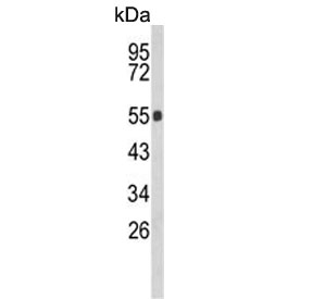 Western blot testing of mouse lung lysate with Glucosylceramidase beta antibody. Predicted molecular weight ~60 kDa.