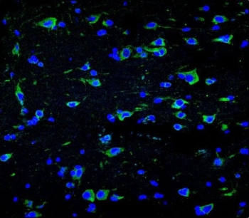 Immunofluorescent staining of brain tissue with Neurofilament-66 antibody (green) and DAPI nuclear stain (blue).