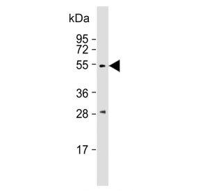 Western blot testing of human liver lysate with Angiopoietin 2 antibody. Predicted molecular weight ~57 kDa.