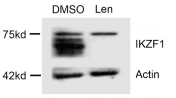 IKZF1 Antibody Lenalidomide Degradation WB. Western blot analysis of multiple myeloma cell lysates treated with DMSO vehicle control or lenalidomide using IKZF1 Antibody demonstrates detection of IKZF1 (Ikaros) at approximately 58â75 kDa. Strong IKZF1 expression is observed in DMSO-treated cells, while treatment with lenalidomide results in a marked reduction of IKZF1 protein levels, consistent with the known cereblon-dependent degradation of Ikaros induced by immunomodulatory drugs. The reduction in signal following lenalidomide treatment supports the specificity of the antibody for IKZF1 and demonstrates its utility for monitoring pharmacologic modulation of Ikaros expression. Actin serves as a loading control. Predicted molecular weight: ~58 kDa. Observed molecular weight: approximately 58â75 kDa, consistent with known IKZF1 isoforms and post-translationally modified forms.