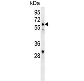 Western blot testing of human CEM cell lysate with IKAROS antibody. Predicted molecular weight ~58 kDa. 