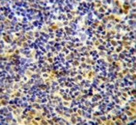 IKAROS Antibody Human Tonsil IHC. Immunohistochemical staining of FFPE human tonsil tissue using IKAROS Antibody demonstrates prominent nuclear HRP-DAB brown staining within subsets of lymphoid cells. The staining pattern is consistent with expression of Ikaros (IKZF1), a zinc finger transcription factor that functions as a master regulator of lymphocyte differentiation, hematopoietic development, and immune cell lineage commitment. Predominantly nuclear immunoreactivity is expected for this DNA-binding protein and highlights its critical role in controlling transcriptional programs required for normal immune system development and lymphoid cell function. The observed staining supports the utility of this antibody for immunohistochemical detection of endogenous IKZF1 in lymphoid tissues. HIER: steam section in pH6 citrate buffer for 20 min and allow to cool prior to staining.