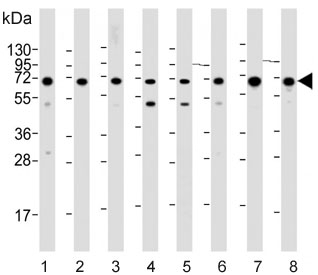 Western blot testing of human 1) HEK293, 2) RD, 3) Karpas 299, 4) Raji, 5) Jurkat, 6) HeLa, 7) HepG2 and 8) mouse NIH 3T3 cell lysate with IGF2BP1 antibody. Predicted molecular weight ~64 kDa.