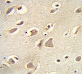 IHC testing of FFPE human brain tissue with MCH Receptor 1 antibody. HIER: steam section in pH6 citrate buffer for 20 min and allow to cool prior to staining.
