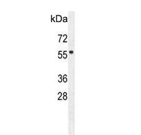 Western blot testing of human HeLa cell lysate with FBXW8 antibody. Predicted molecular weight ~67 kDa.