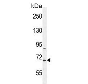 Western blot testing of human HepG2 cell lysate with BUD13 antibody. Predicted molecular weight ~71 kDa.