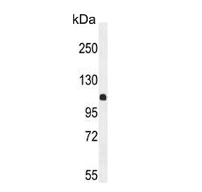 Western blot testing of human K562 cell lysate with Estrogen-induced gene 121-like protein antibody. Predicted molecular weight ~114 kDa.