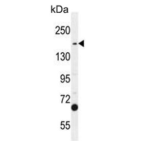 Western blot testing of human A549 cell lysate with TDRD7 antibody. Expected molecular weight: 124-160 kDa.