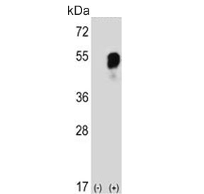 Western blot testing of 1) non-transfected and 2) transfected 293 cell lysate with Prolyl-tRNA synthetase antibody. Predicted molecular weight ~53 kDa.