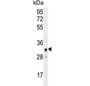 Western blot testing of human A2058 cell lysate with UBXN2A antibody. Predicted molecular weight ~29 kDa.