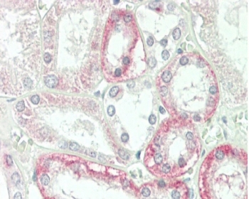IHC testing of FFPE human kidney tissue with CPM antibody. HIER: steam section in pH6 citrate buffer for 20 min and allow to cool prior to staining.