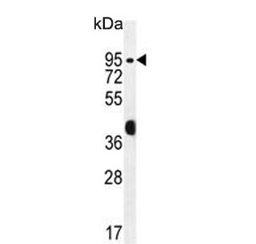 Western blot testing of human MCF7 cell lysate with Rac GTPase-activating protein 1 antibody. Predicted molecular weight ~71 kDa.
