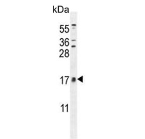 CNIH2 Antibody WB. Western blot testing of human HL60 cell lysate with CNIH2 antibody. Predicted molecular weight ~19 kDa.