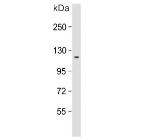 Western blot testing of rat eyeball tissue lysate with Retinal guanylyl cyclase 1 antibody. Predicted molecular weight ~120 kDa.