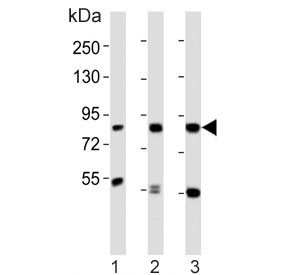 Western blot testing of human 1) K562, 2) LNCaP and 3) HL60 cell lysate with CD168 antibody. Expected molecular weight ~72 kDa (cell surface form) and 85-95 kDa (intracellular form).