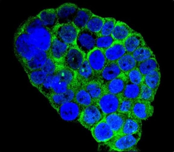 Immunofluorescent staining of human WiDr cells with C1QC antibody (green) and DAPI nuclear stain (blue).