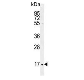 Western blot testing of human HL60 cell lysate with C1QC antibody. Predicted molecular weight ~26 kDa.