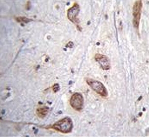 IHC testing of FFPE human brain tissue with Phospholipase C-L2 antibody. HIER: steam section in pH6 citrate buffer for 20 min and allow to cool prior to staining.