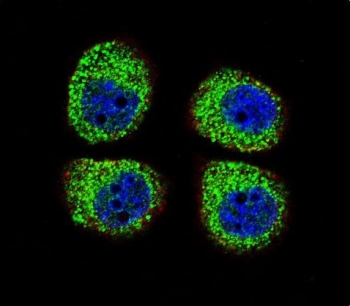 Immunofluorescent staining of human A549 cells with ARRB1 antibody (green), DAPI nuclear stain (blue) and anti-Actin (red).
