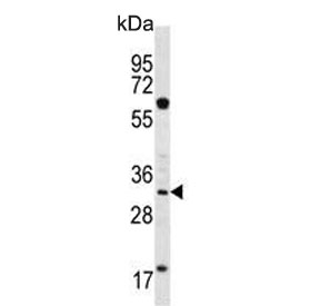 Western blot testing of human K562 cell lysate with Ficolin 3 antibody. Predicted molecular weight ~33 kDa.