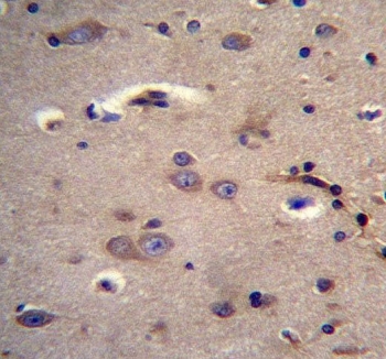 IHC testing of FFPE human brain tissue with Dystrobrevin alpha antibody. HIER: steam section in pH6 citrate buffer for 20 min and allow to cool prior to staining.