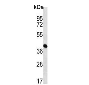 Western blot testing of human K562 cell lysate with ADE2 antibody. Predicted molecular weight ~47 kDa.